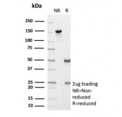SDS-PAGE analysis of purified, BSA-free Cyclin D1 antibody (clone CCND1/12039) as confirmation of integrity and purity.