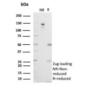 SDS-PAGE analysis of purified, BSA-free S100A4 antibody (clone S100A4/6801) as confirmation of integrity and purity.