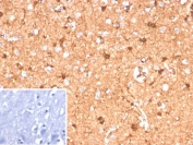 IHC staining of FFPE human brain tissue with recombinant S100B antibody (clone S100B/12587R). Inset: PBS used in place of primary Ab (secondary Ab negative control). HIER: boil tissue sections in pH 9 10mM Tris with 1mM EDTA for 20 min and allow to cool before testing.