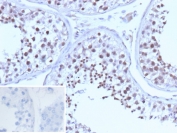 IHC staining of FFPE human testis tissue with recombinant BRCA1 antibody (clone BRCA1/13502R). Inset: PBS used in place of primary Ab (secondary Ab negative control). HIER: boil tissue sections in pH 9 10mM Tris with 1mM EDTA for 20 min and allow to cool before testing.