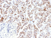 IHC staining of FFPE human adrenal gland tissue with mtTFA antibody (clone TFAM/9713). Inset: PBS used in place of primary Ab (secondary Ab negative control). HIER: boil tissue sections in pH 9 10mM Tris with 1mM EDTA for 20 min and allow to cool before testing.