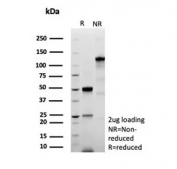 SDS-PAGE analysis of purified, BSA-free recombinant Tumor Protein 53 antibody (clone TP53/8183R) as confirmation of integrity and purity.