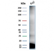 Western blot testing of human Raji tissue lysate with recombinant Ubiquitin antibody (clone rUBB/9476).