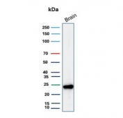 Western blot testing of human brain tissue lysate with PGP9.5 antibody (clone UCHL1/8153). Predicted molecular weight ~25 kDa.