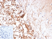 IHC staining of FFPE human brain tissue with recombinant Calretinin antibody (clone CALB2/4688R). Inset: PBS used in place of primary Ab (secondary Ab negative control). HIER: boil tissue sections in pH 9 10mM Tris with 1mM EDTA for 20 min and allow to cool before testing.