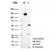 SDS-PAGE analysis of purified, BSA-free TFPI2 antibody (clone TFPI2/13025) as confirmation of integrity and purity.