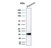 Western blot testing of human placenta tissue lysate with Tissue factor pathway inhibitor 2 antibody (clone TFPI2/13027). Expected molecular weight: ~27 kDa (unmodified), 30-35 kDa (glycosylated).