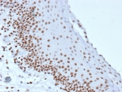 IHC staining of FFPE human tonsil tissue with Phosphorylated Histone H3 antibody (clone rHH3/9924). HIER: boil tissue sections in pH 9 10mM Tris with 1mM EDTA for 20 min and allow to cool before testing.