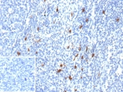 IHC staining of FFPE human tonsil tissue with CD83 antibody (clone 1H4b). Inset: PBS used in place of primary Ab (secondary Ab negative control). HIER: boil tissue sections in pH 9 10mM Tris with 1mM EDTA for 20 min and allow to cool before testing.