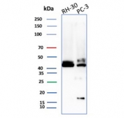Western blot testing of human RH30 and PC-3 cell lysate with CD83 antibody. Expected molecular weight: ~23-60 kDa depending on level of glycosylation.