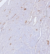 IHC staining of FFPE human uterus tissue with CD34 antibody (clone CD34/7717). HIER: boil tissue sections in pH 9 10mM Tris with 1mM EDTA for 20 min and allow to cool before testing.