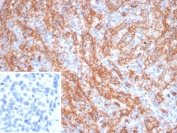 IHC staining of FFPE human spleen tissue with Platelet glycoprotein 4 antibody (clone CD36/7216). Inset: PBS used in place of primary Ab (secondary Ab negative control). HIER: boil tissue sections in pH 9 10mM Tris with 1mM EDTA for 20 min and allow to cool before testing.