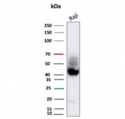 Western blot testing of human Raji tissue lysate with ADP-ribosyl cyclase 1 antibody (clone CD38/9332). Expected molecular weight: 34-46 kDa depending on glycosylation level.