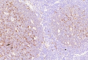 IHC staining of FFPE human tonsil tissue with ADP-ribosyl cyclase 1 antibody (clone CD38/9332). Inset: PBS used in place of primary Ab (secondary Ab negative control). HIER: boil tissue sections in pH 9 10mM Tris with 1mM EDTA for 20 min and allow to cool before testing.