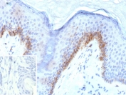 IHC staining of FFPE human dkin tissue with PSAP antibody (clone KLK4/8943). Inset: PBS used in place of primary Ab (secondary Ab negative control). HIER: boil tissue sections in pH 9 10mM Tris with 1mM EDTA for 20 min and allow to cool before testing.