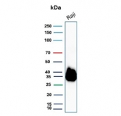 Western blot testing of human Raji cell lysate with CD74 antibody (clone CLIP/7947). Expected molecular weight: 33-43 kDa.