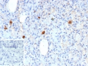 IHC staining of FFPE human CMV-infected tissue with Cytomegalovirus antibody (clone rCMV/9827). Inset: PBS used in place of primary Ab (secondary Ab negative control). HIER: boil tissue sections in pH 9 10mM Tris with 1mM EDTA for 20 min and allow to cool before testing.