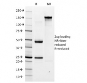 SDS-PAGE analysis of purified, BSA-free Helicobacter pylori antibody (clone HP/1334) as confirmation of integrity and purity.