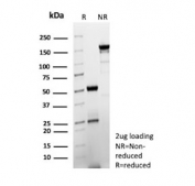 SDS-PAGE analysis of purified, BSA-free Cytochrome P450 2C9 antibody (clone CYP2C9/13122) as confirmation of integrity and purity.