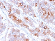 IHC staining of FFPE human adrenal gland tissue with Clusterin antibody (clone CLU/6692). HIER: boil tissue sections in pH 9 10mM Tris with 1mM EDTA for 20 min and allow to cool before testing.