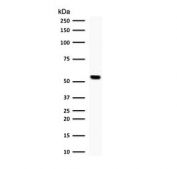 Western blot testing of human Jurkat cell lysate with TOP1MT antibody (clone TPIMT-1). Predicted molecular weight ~66 kDa.