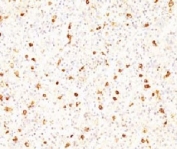 IHC testing of FFPE human pituitary with LHB antibody (clone CCGD1).