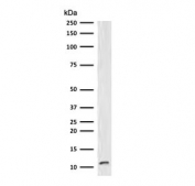 Western blot testing of human Raji cell lysate with B2M antibody (clone MGBP2-1).