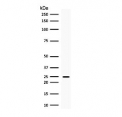 Western blot testing of human brain lysate with PGP9.5 antibody (clone UBCE-L1). Predicted molecular weight ~25 kDa.