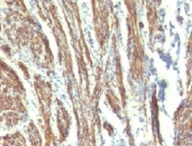 IHC testing of FFPE human uterus with CAD antibody (clone CDSM-3).