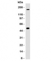 Western blot testing of HCT116 cell lysate with CAIX antibody (clone CBAD9-1). Predicted molecular weight: 50-55 kDa but may be observed at higher molecular weights due to glycosylation.