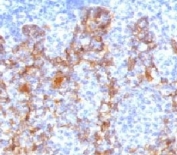 IHC testing of FFPE human tonsil with Acidic Cytokeratin antibody (clone ACCK1-1).