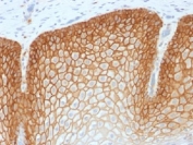 IHC testing of FFPE human tonsil with recombinant CD44v4 antibody (clone CD44v4/1700). Required HIER: steam sections in pH 9 10mM Tris with 1mM EDTA buffer for 20 min.
