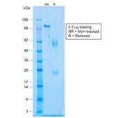 SDS-PAGE analysis of purified, BSA-free recombinant Caldesmon antibody (clone CALD1/1424R) as confirmation of integrity and purity.
