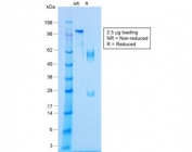 SDS-PAGE analysis of purified, BSA-free recombinant NKX2.2 antibody (clone NX2/1422R) as confirmation of integrity and purity.