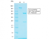 SDS-PAGE analysis of purified, BSA-free recombinant TYRP1 antibody (clone TYRP1/1564R) as confirmation of integrity and purity.