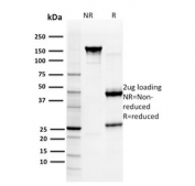 SDS-PAGE analysis of purified, BSA-free GSTM3 antibody (clone CPTC-GSTMu3-1) as confirmation of integrity and purity.