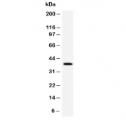 Western blot testing of human HeLa cell lysate with RPSA antibody (clone LMNR-1). Routinely observed molecular weight: 37-40 kDa and 67 kDa.