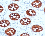 IHC testing of human colon with KRT20 antibody (clone CTKN20-1). Required HIER: boil tissue sections in 10mM citrate buffer, pH 6, for 10-20 min followed by cooling at RT for 20 min.