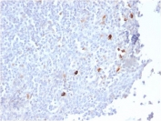 IHC staining of FFPE human tonsil tissue with recombinant IgM antibody (clone IGHM/2559R). HIER: boil tissue sections in pH 9 10mM Tris with 1mM EDTA for 10-20 min and allow to cool before testing.