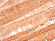 IHC staining of FFPE rat skeletal muscle with Myoglobin antibody (clone MB/2105). HIER: boil tissue sections in pH6, 10mM citrate buffer, for 10-20 min and allow to cool before testing.