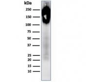 Western blot testing of human spleen lysate with recombinant CD45 antibody.
