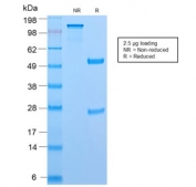 SDS-PAGE analysis of purified, BSA-free recombinant CD45RB antibody (clone PTPRC/2877R) as confirmation of integrity and purity.