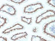 IHC staining of FFPE human small intestine with HNF1A antibody (clone HNF1A/2087). HIER: boil tissue sections in pH6, 10mM citrate buffer, for 10-20 min and allow to cool before testing.