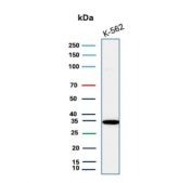 Western blot testing of human K562 cell lysate with CA8 antibody. 