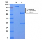SDS-PAGE analysis of purified, BSA-free recombinant CD59 antibody (clone MACIF/2867R) as confirmation of integrity and purity.