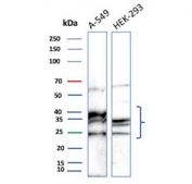 Western blot testing of human A549 and HEK293 cell lysate with CDC34 antibody.