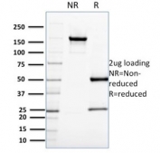 SDS-PAGE analysis of purified, BSA-free CDC34 antibody (clone CPTC-CDC34-2) as confirmation of integrity and purity.