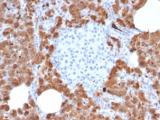 IHC testing of FFPE human pancreas with Carboxypeptidase A1 antibody (clone CPA1/2714). HIER: boil tissue sections in pH6, 10mM citrate buffer, for 10-20 min followed by cooling at RT for 20 min.