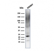 Western blot testing of human kidney lysate with FTL antibody. Predicted molecular weight ~20 kDa.