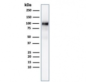Western blot testing of human pancreas lysate with recombinant GP2 antibody (clone GP2/3134R).